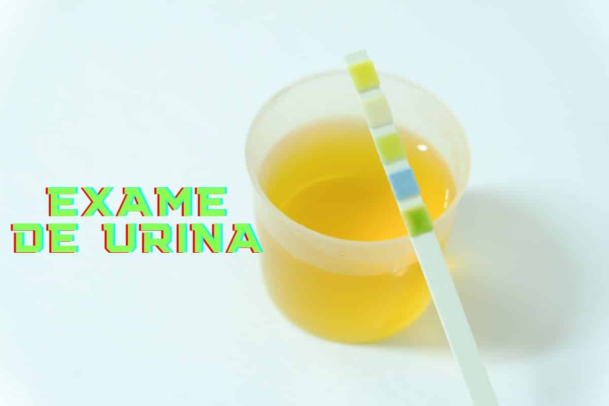 Por que exame de urina tem que ser o primeiro jato da manhã? 1 exame de urina Canva
