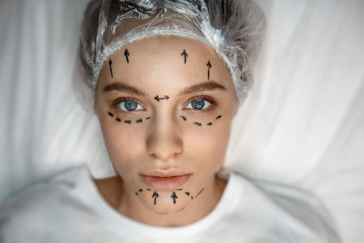 Quanto tempo dura a harmonização facial? Saiba quando o procedimento precisa ser renovado 1 quanto tempo dura a harmonização facial