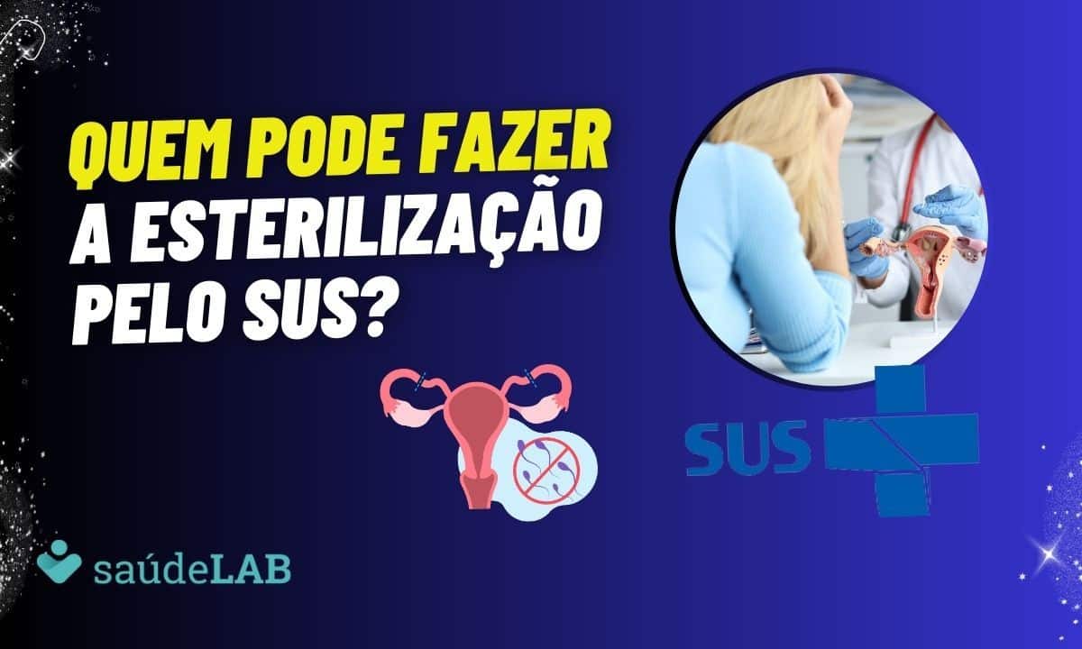 Laqueadura pelo SUS: o que precisa para conseguir fazer? 1 Laqueadura pelo SUS.