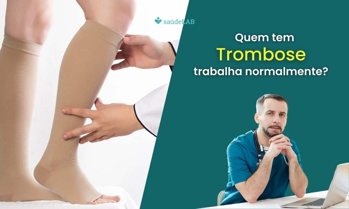 Quem tem trombose trabalha normalmente.