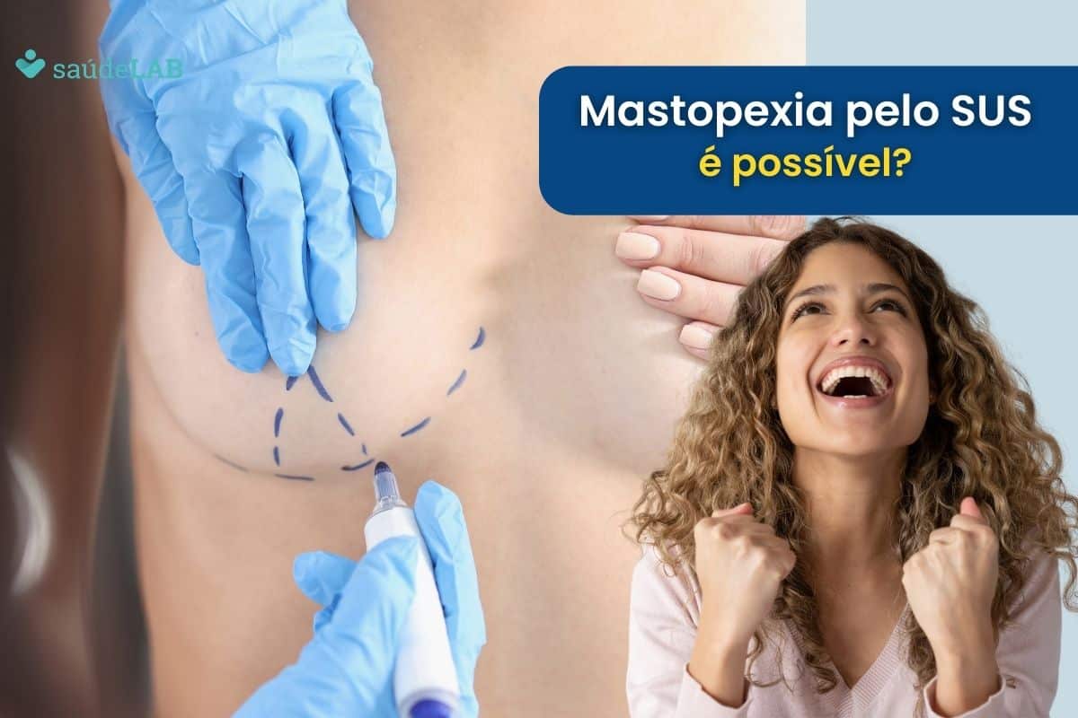 Mastopexia pelo SUS: Será que é possível fazer? Entenda 1 Mastopexia pelo SUS.