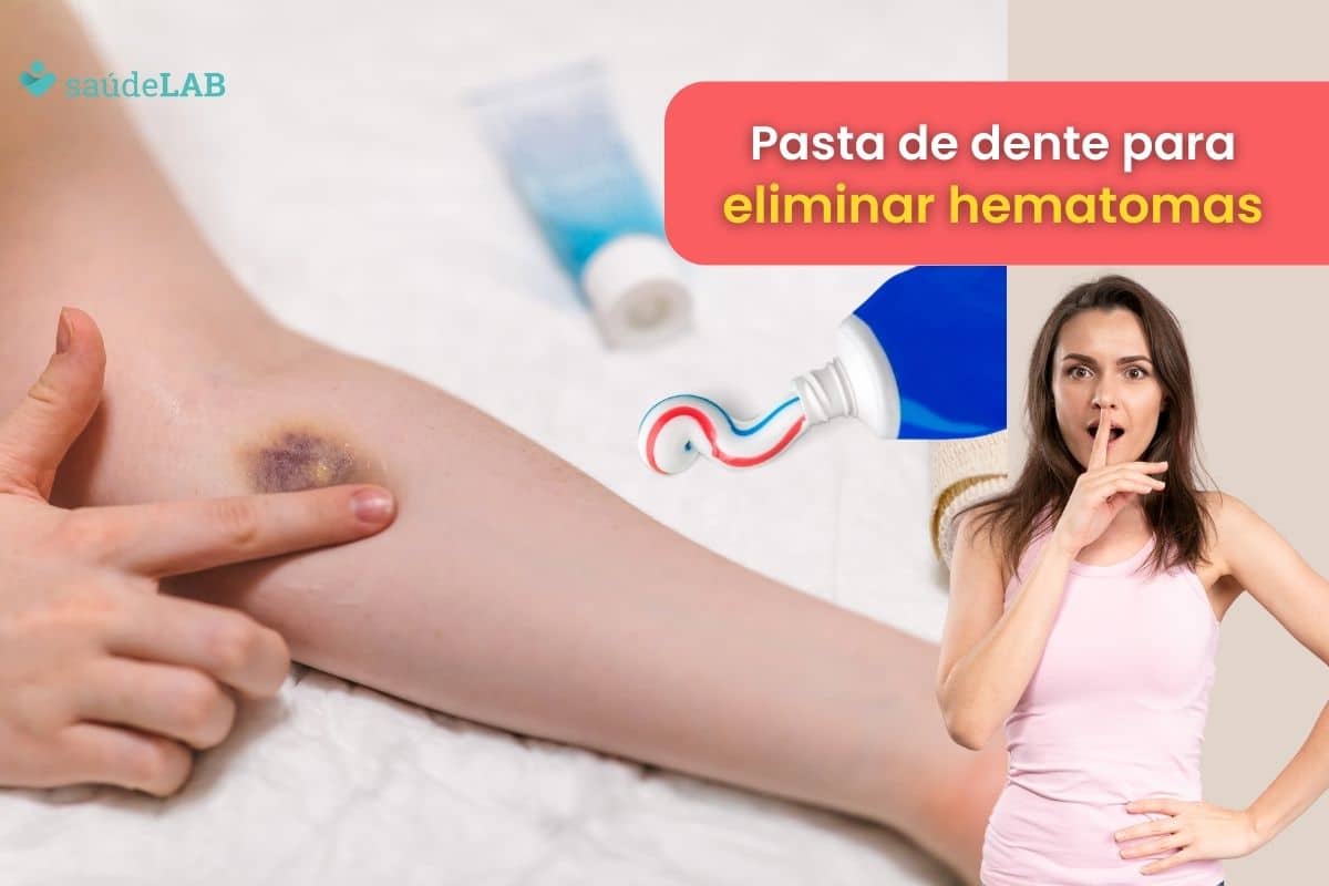 Como tirar roxo da pele com pasta de dente? Veja se o método funciona 1 como tirar roxo da pele com pasta de dente.