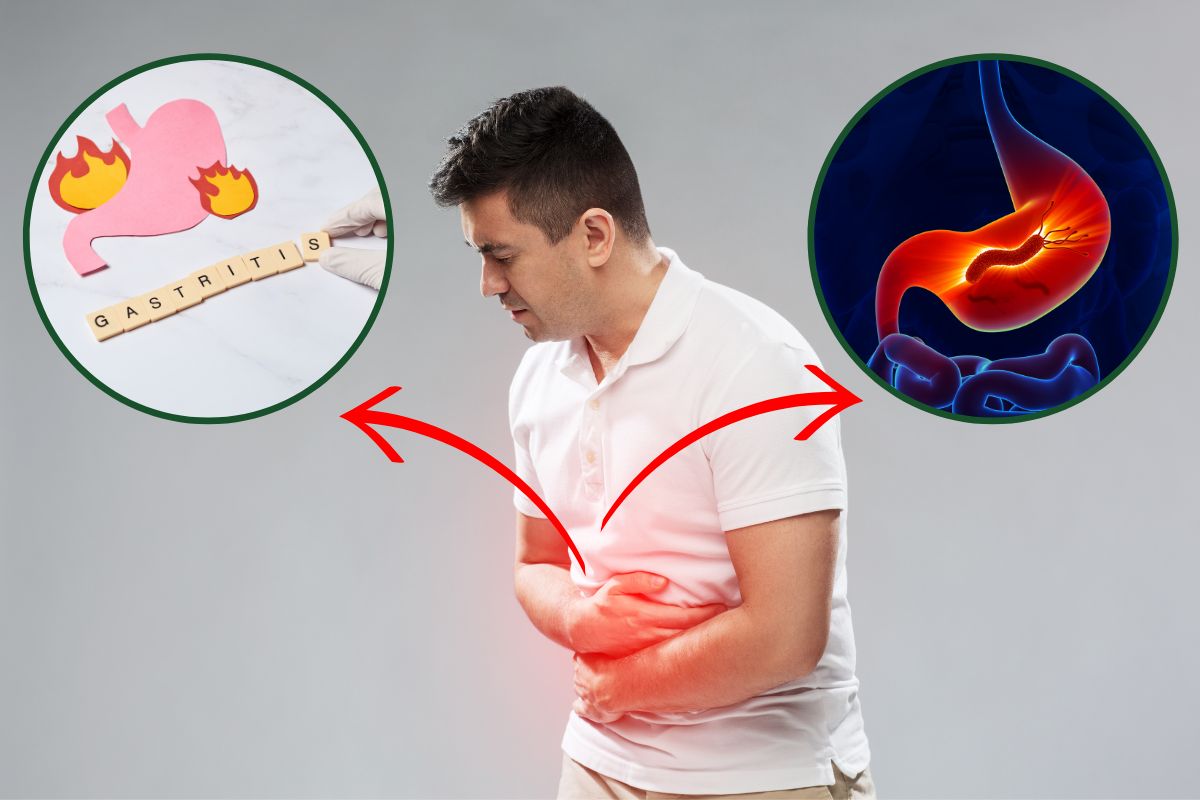 Como pega H. pylori? Entenda as causas, tratamento e mais 1 Como pega H. pylori.