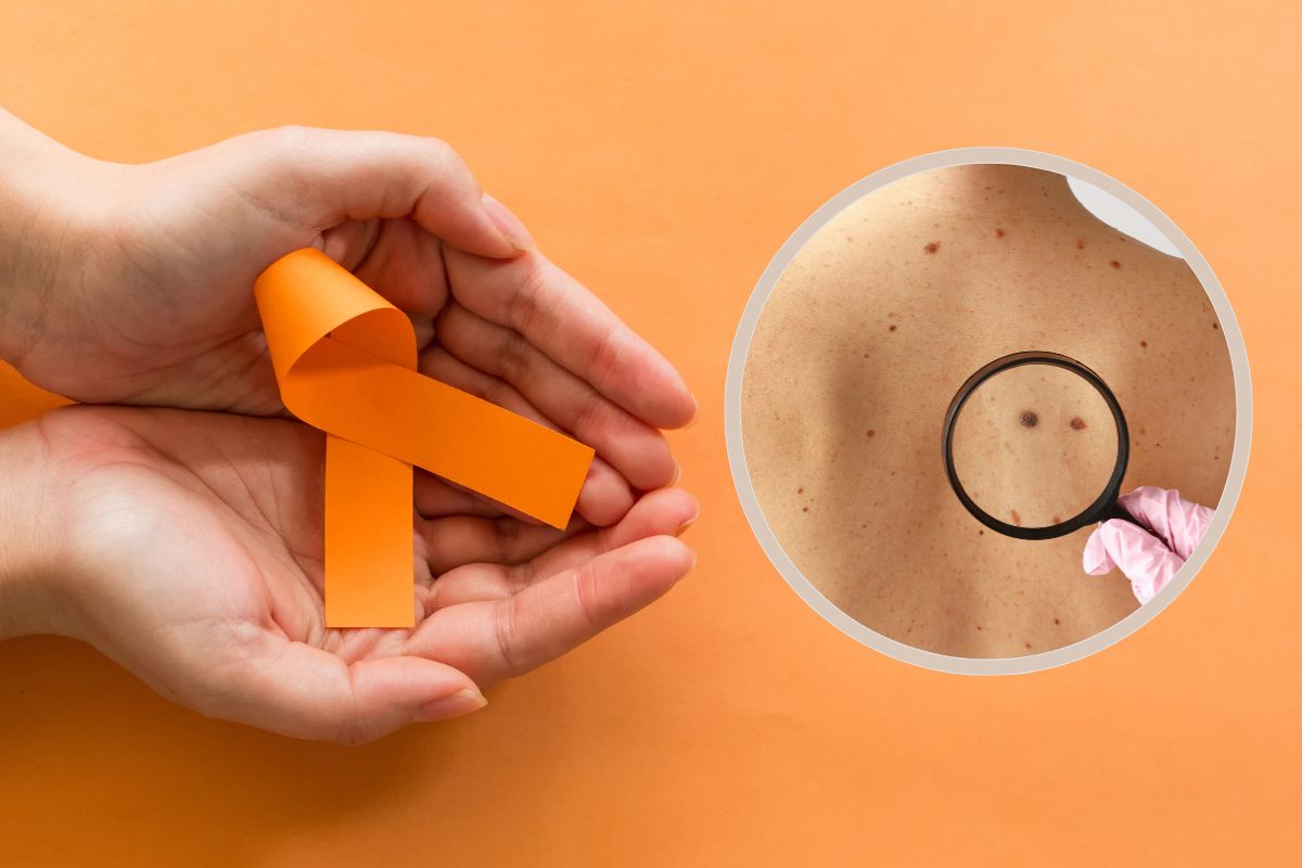 Câncer de Pele e o Dezembro Laranja: Vou te contar o que tenho visto 1 Câncer de pele e o dezembro laranja.