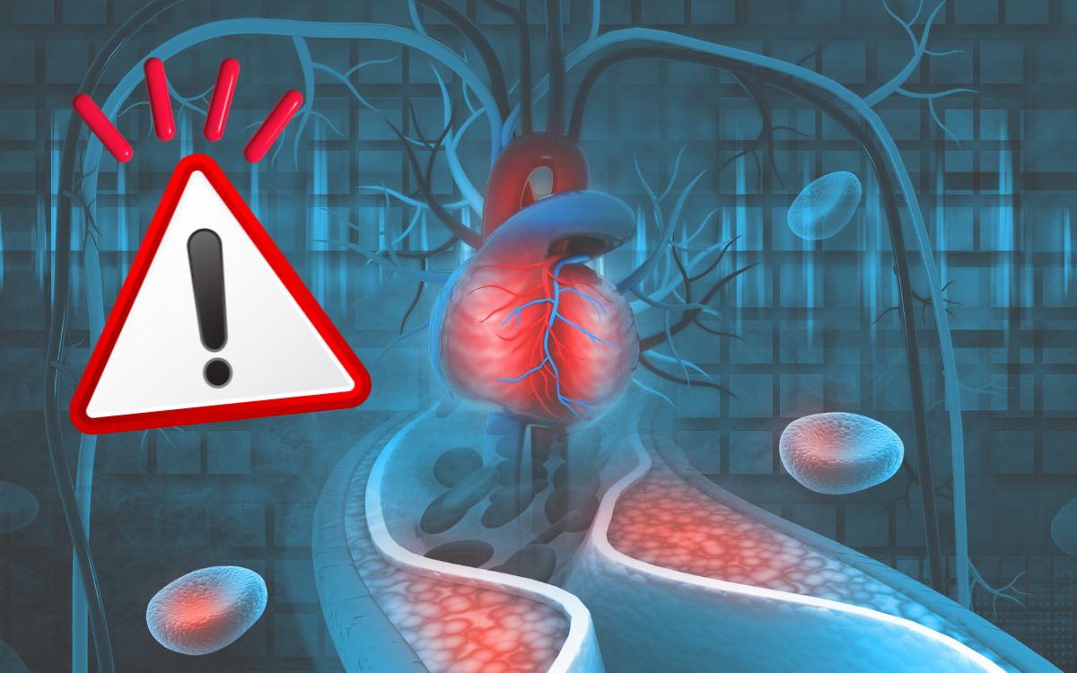 Nova diretriz de colesterol: veja o que muda na prevenção de infarto e AVC 1 Nova diretriz de colesterol.